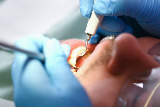 Best Root Canal Emergency Dentist  in Dilkon, AZ